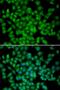 Cyclin-dependent kinase 4 inhibitor C antibody, orb135251, Biorbyt, Immunocytochemistry image 