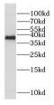 Cytochrome C Oxidase Assembly Factor COX18 antibody, FNab01896, FineTest, Western Blot image 