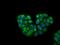 Potassium Channel Tetramerization Domain Containing 5 antibody, NBP2-02414, Novus Biologicals, Immunocytochemistry image 