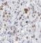 DExD-Box Helicase 39B antibody, FNab09142, FineTest, Immunohistochemistry frozen image 