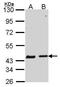 Serpin Family B Member 6 antibody, GTX114637, GeneTex, Western Blot image 