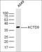 Killer Cell Lectin Like Receptor C4 antibody, orb184531, Biorbyt, Western Blot image 