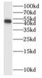 SMAD Family Member 7 antibody, FNab07999, FineTest, Western Blot image 