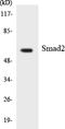 HsMAD2 antibody, LS-C200707, Lifespan Biosciences, Western Blot image 