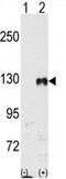 EPHB1 antibody, GTX81349, GeneTex, Western Blot image 