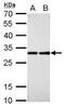 Ribosomal Protein L7a antibody, GTX114727, GeneTex, Western Blot image 