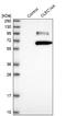 C-Type Lectin Domain Containing 14A antibody, NBP2-30854, Novus Biologicals, Western Blot image 