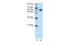 Cbl Proto-Oncogene Like 1 antibody, ARP39623_T100, Aviva Systems Biology, Western Blot image 