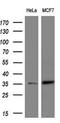 ERCC Excision Repair 1, Endonuclease Non-Catalytic Subunit antibody, GTX84559, GeneTex, Western Blot image 