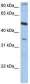 Plexin Domain Containing 1 antibody, TA338415, Origene, Western Blot image 