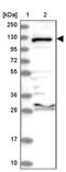 Endoplasmic reticulum aminopeptidase 2 antibody, PA5-56955, Invitrogen Antibodies, Western Blot image 