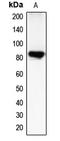 CHM Like Rab Escort Protein antibody, LS-C351996, Lifespan Biosciences, Western Blot image 