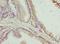 Chromosome 17 Open Reading Frame 64 antibody, A65850-100, Epigentek, Immunohistochemistry paraffin image 