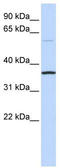 Chromosome 16 Open Reading Frame 46 antibody, TA338820, Origene, Western Blot image 
