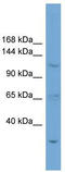 Zinc Finger Protein 624 antibody, TA339741, Origene, Western Blot image 