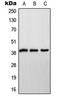 NADH:Ubiquinone Oxidoreductase Subunit A9 antibody, LS-C352558, Lifespan Biosciences, Western Blot image 