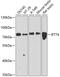 Intraflagellar Transport 74 antibody, GTX64834, GeneTex, Western Blot image 