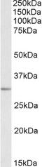 Microtubule-associated protein RP/EB family member 3 antibody, EB09827, Everest Biotech, Western Blot image 