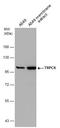 Transient Receptor Potential Cation Channel Subfamily C Member 6 antibody, GTX113859, GeneTex, Western Blot image 