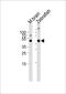 PCIF1 antibody, PA5-49673, Invitrogen Antibodies, Western Blot image 