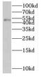 Makorin Ring Finger Protein 2 antibody, FNab05206, FineTest, Western Blot image 