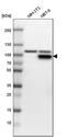 Phosphofructokinase, Muscle antibody, PA5-51687, Invitrogen Antibodies, Western Blot image 