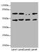 Keratin 18 antibody, A53182-100, Epigentek, Western Blot image 