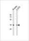 Protein HEXIM2 antibody, 61-257, ProSci, Western Blot image 