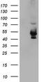 Potassium Voltage-Gated Channel Subfamily A Member Regulatory Beta Subunit 1 antibody, M06063-2, Boster Biological Technology, Western Blot image 