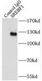 Sterol Regulatory Element Binding Transcription Factor 1 antibody, FNab08220, FineTest, Immunoprecipitation image 