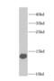 Fatty Acid Binding Protein 1 antibody, FNab02928, FineTest, Western Blot image 