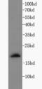 Interferon Gamma antibody, FNab04358, FineTest, Immunohistochemistry frozen image 