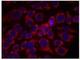 ERBB2 antibody, NB100-81960, Novus Biologicals, Immunofluorescence image 