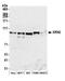 5'-3' Exoribonuclease 2 antibody, A301-101A, Bethyl Labs, Western Blot image 