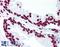 ShcA antibody, LS-B1489, Lifespan Biosciences, Immunohistochemistry paraffin image 
