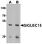 Sialic Acid Binding Ig Like Lectin 15 antibody, orb75740, Biorbyt, Western Blot image 