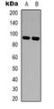 FES Proto-Oncogene, Tyrosine Kinase antibody, orb318770, Biorbyt, Western Blot image 
