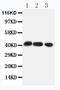 C-C chemokine receptor type 4 antibody, PA1517, Boster Biological Technology, Western Blot image 