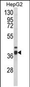 Enoyl-CoA Delta Isomerase 2 antibody, PA5-72558, Invitrogen Antibodies, Western Blot image 
