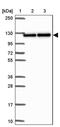 Spectrin Repeat Containing Nuclear Envelope Family Member 3 antibody, PA5-63090, Invitrogen Antibodies, Western Blot image 