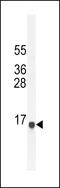 He2 antibody, 55-456, ProSci, Western Blot image 