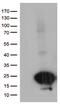 SCP2 Sterol Binding Domain Containing 1 antibody, CF812873, Origene, Western Blot image 