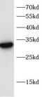 Mediator Complex Subunit 19 antibody, FNab10754, FineTest, Western Blot image 