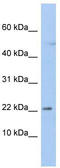 Chromosome 19 Open Reading Frame 25 antibody, TA335385, Origene, Western Blot image 