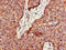Palmitoyl-Protein Thioesterase 1 antibody, CSB-PA018587LA01HU, Cusabio, Immunohistochemistry frozen image 