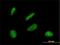 Protein DBF4 homolog A antibody, H00010926-M01, Novus Biologicals, Immunofluorescence image 