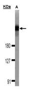 Dedicator Of Cytokinesis 1 antibody, LS-C185349, Lifespan Biosciences, Western Blot image 