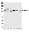 UPF1 RNA Helicase And ATPase antibody, A300-038A, Bethyl Labs, Western Blot image 