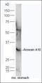 Protein Kinase D3 antibody, orb4440, Biorbyt, Western Blot image 