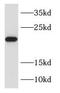 Ras-related protein Rab-31 antibody, FNab07014, FineTest, Western Blot image 